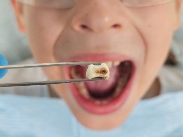 Best Pediatric Emergency Dentist in Reston, VA
