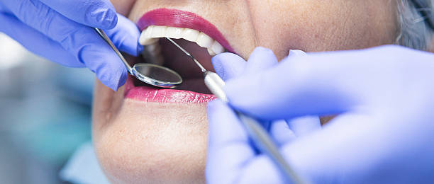 Best Emergency Root Canal Treatment in Reston, VA